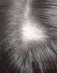 Результати Plinest Hair  фото до #1