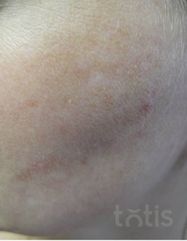 Результати 02 Me Line Caucasian Skin Night  фото после #2