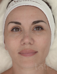 Výsledky Whitening Peel-Off Masks  фото до #1