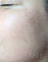 Результати 02 Me Line Caucasian Skin Day  фото после #2