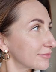 Результати Professional Peptide Perfection Exfoliator  фото до #1