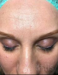 Результати Vitamin C Cream  фото до #1