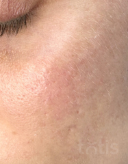 Výsledky Enzyme Peeling Mask  фото после #2