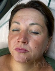 Результаты OXYGEN Deep Pore Masque  фото до #1