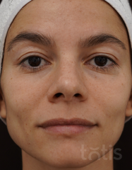 Результати Propolis Day Cream  фото после #2