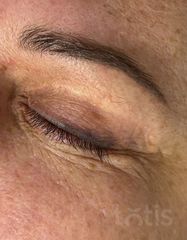 Результаты ULTIMATE EYE CORRECTOR  фото до #1