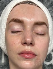Результати 560 Lumin’Éclat Beutifying Cream  фото до #1