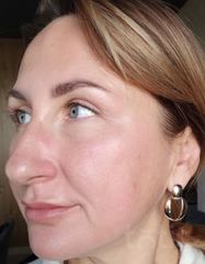 Результати Professional Peptide Perfection Exfoliator  фото после #2