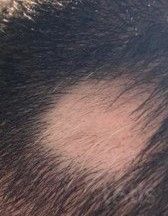 Результати Plinest Hair  фото до #1