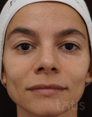 Výsledky Enzyme Peeling Mask  фото после #2