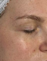 Результаты 450 Nutri'vital Eye Contour Cream  фото после #2