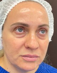 Результати 02 Me Line Caucasian Skin Night  фото до #1