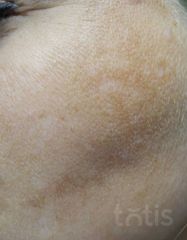 Результати 01 Me Line Caucasian Skin  фото до #1