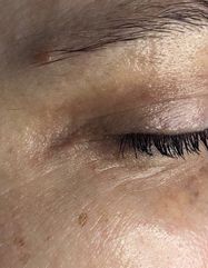 Результати EYE REVITALIZER  фото после #2
