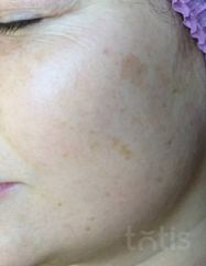 Результати 02 Me Line Caucasian Skin Night  фото до #1