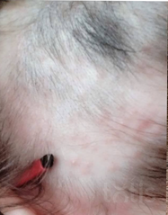 Результаты HAIR LOSS CONTROL  фото до #1