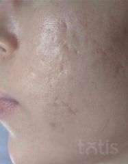 Rezultate SKIN RECOVERY  фото после #2