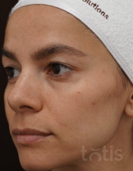 Rezultate Terra California Clay Mask  фото до #1