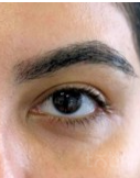 Результати PolyPhil eye  фото после #2