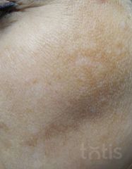 Результати 02 Me Line Caucasian Skin Day  фото до #1