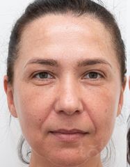Výsledky Facetem S 0.8mlx2  фото до #1