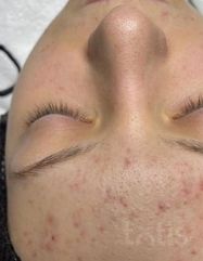 Rezultate SKIN RECOVERY  фото после #2