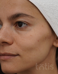 Výsledky Enzyme Peeling Mask  фото после #2