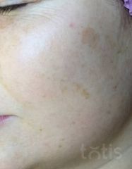 Результати 02 Me Line Caucasian Skin Day  фото до #1