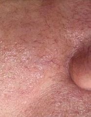 Результати Lipotrofin Ion Serum  фото до #1