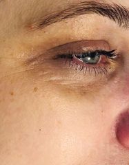 Результати EYE REVITALIZER  фото до #1