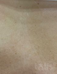 Результаты 3090 Modelling Cream  фото после #2
