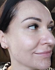 Результати OXYGEN Deep Pore Masque  фото после #2