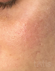 Výsledky Enzyme Peeling Mask  фото до #1