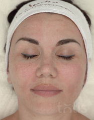Výsledky Beauty Mask  фото до #1