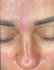 Результати OXYGEN Deep Pore Masque  фото после #2
