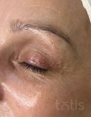 Результаты 450 Nutri'vital Eye Contour Cream  фото после #2