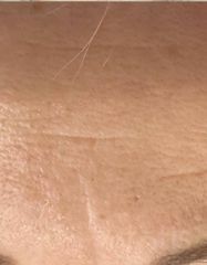 Результати AGE RESCUE 24H CREAM  фото до #1