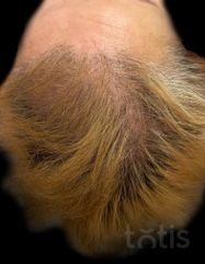 Результаты HAIR LOSS CONTROL  фото после #2