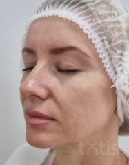 Результати EPIGEN AGE PERFECTION SERUM  фото до #1