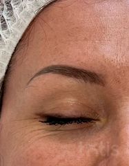 Результаты 650 Lift'Expert Wrinkle Smoother  фото до #1