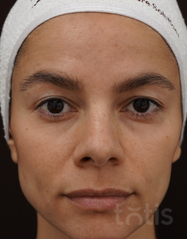 Výsledky Enzyme Peeling Mask  фото до #1