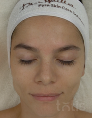 Rezultaty Purifying Peel Off Mask  фото до #1