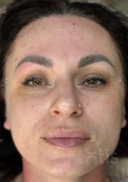 Результаты Professional Peptide Perfection Exfoliator  фото после #2