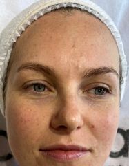 Результаты 450 Nutri'vital Eye Contour Cream  фото до #1