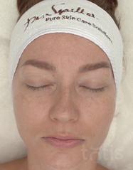 Výsledky Collagen Intensive Fleece Mask Fotky pred #1
