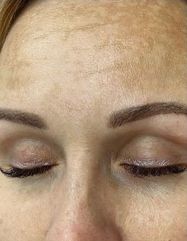 Результати 02 Me Line Caucasian Skin Day  фото до #1