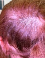 Результаты HAIR LOSS CONTROL  фото после #2