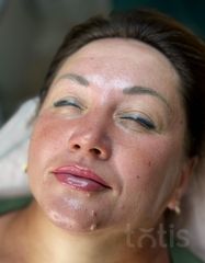 Результаты OXYGEN Deep Pore Masque  фото после #2