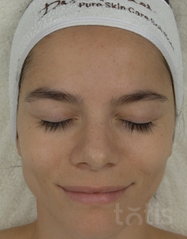Rezultaty Purifying Peel Off Mask  фото после #2