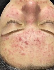 Rezultate SKIN RECOVERY  фото до #1